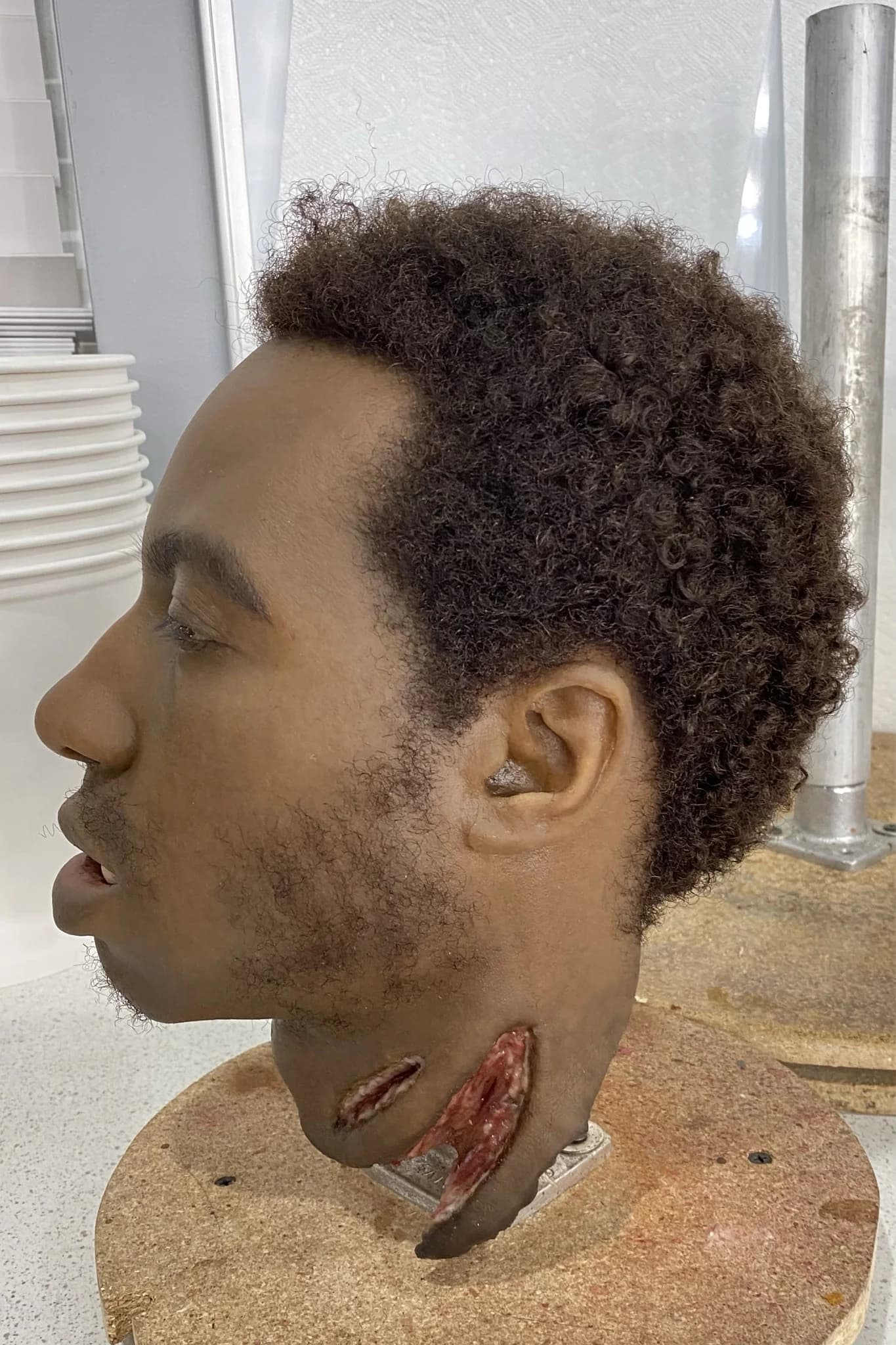 Prosthetic Head Hair Application